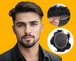 What Is Hair System for Men