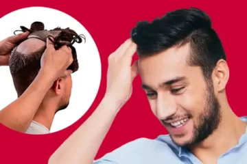 Complete Information What Is Hair Patch